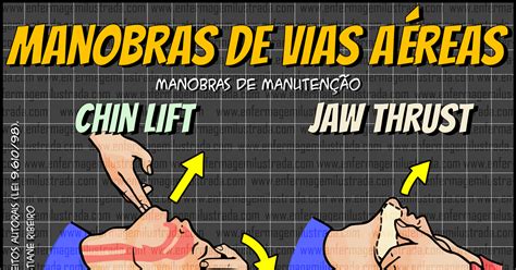 Chin Lift E Jaw Thrust