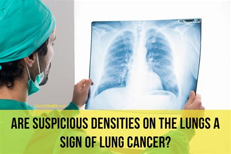 Suspicious Densities On The Lungs A Sign Of Lung Cancer Respiratory