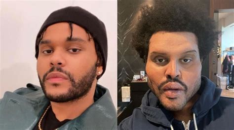 The Weeknd Plastic Surgery Interview South Africa News