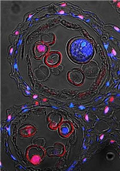 Maybe you would like to learn more about one of these? Cell-Death Mechanism the Same in All Living Things