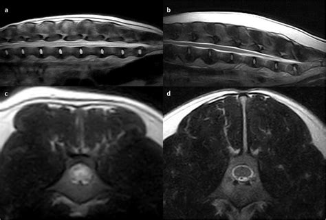 A Midline Sagittal T2 Weighted Fast Spin Echo Image From The Cranial