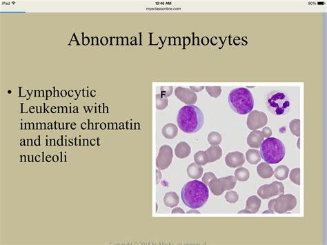 Abnormal Lymphocytes Medical Laboratory Science Medicine Notes