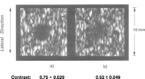 Figure 4 From Simulation Of B Scan Images From Two Dimensional