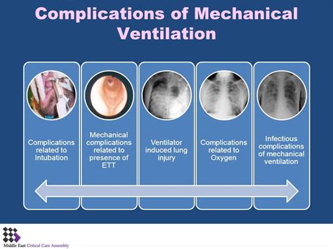 Mechanical Ventilation Complications Of Mechanical Ventilation Ppt