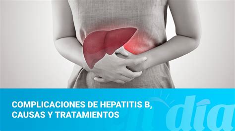 Complicaciones De Hepatitis B Causas Y Tratamientos Youtube