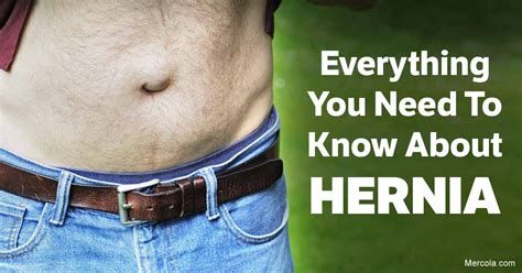 Navel Hernia Symptoms