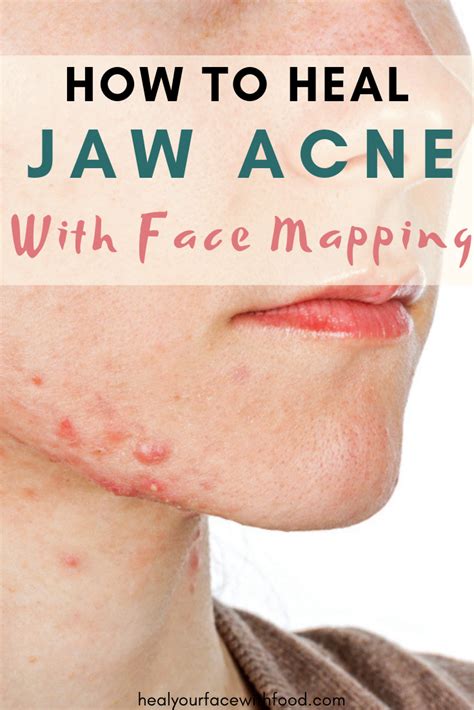 How To Treat Nodular Acne Scars