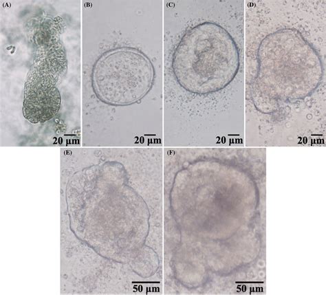 Morphological Change Of The Chicken Small Intestinal Organoids Cultured
