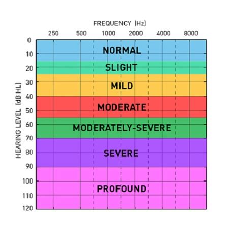 What Is An Audiogram Understanding Hearing Test Results