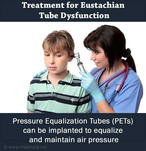 Eustachian Tube Dysfunction Etd Causes Symptoms