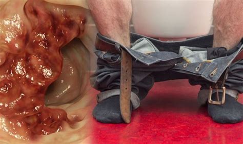 Symptoms of vaginal cancer include bleeding or discharge not related to menstrual periods, pain during sexual intercourse, pain in the pelvic area, and a lump in the vagina. Bowel cancer: Narrow and bloody stools could signal the ...