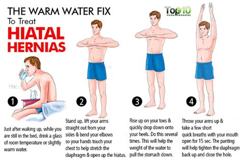 Home Remedies For Hiatal Hernias The Health Coach