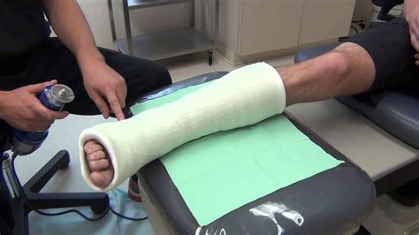 Removing And Bivalving A Cast Youtube