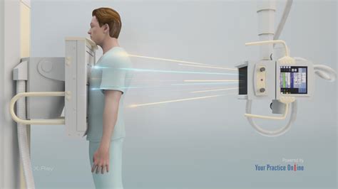 X Ray Procedure Video Diagnostic Imaging Procedures Video