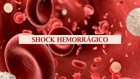 Shock Hemorragico Enfermería Educativa ♡ Udocz
