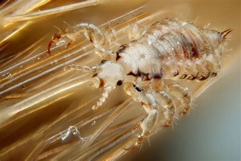 Top 48 Image What Does Lice Look Like In Hair Vn