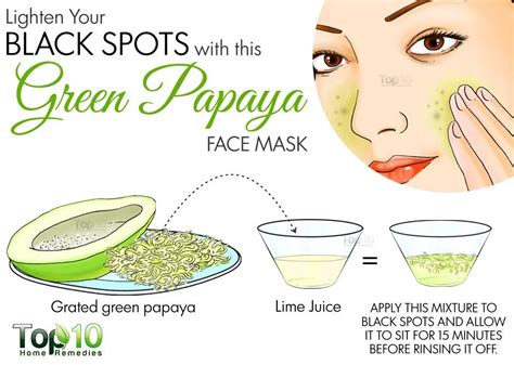 Home Remedies For Black Spots On Your Face Page 3 Of 3 Top 10 Home