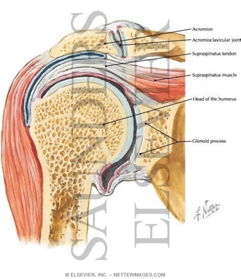 The supraspinatus tendon attaches the supraspinatus muscle, which arise from the shoulder blade, to the head of the arm bone at the shoulder joint. Shoulder Joint, Supraspinatus Muscle