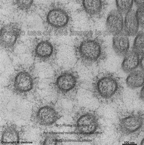 Describe what you might see if you were to look at cells through a microscope. Electron Microscope Real Human Cell - Micropedia