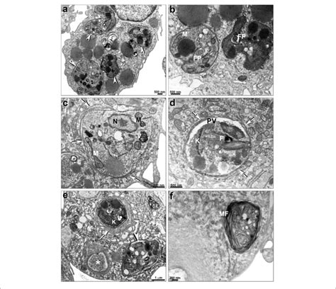 Ultrastructural Effects Of Pf 429242 In L Infantum Intracellular