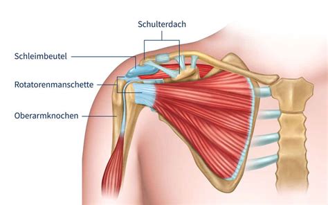 Impingement syndrome of the shoulder. Das schmerzhafte Impingement-Syndrom der Schulter ...