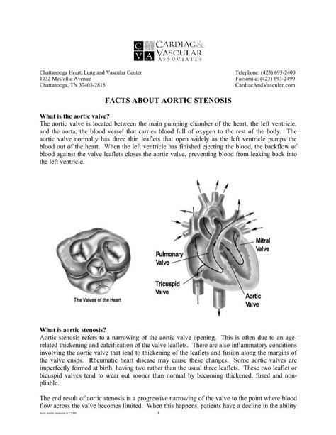Pdf Facts About Aortic Stenosis · Pdf Fileaortic Stenosis Refers To