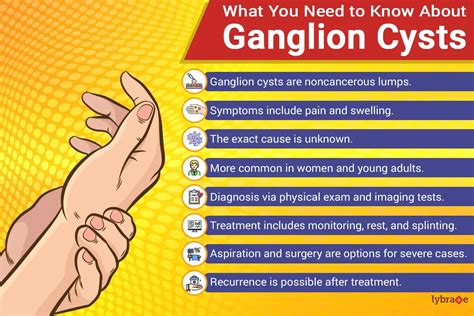Understanding Ganglion Cysts Causes Symptoms And Treatment Ask The Nurse Expert