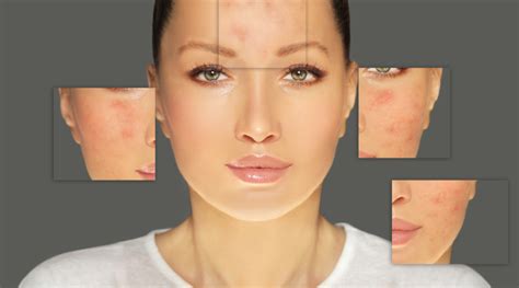 Skin Diseases A Look Into Its Various Types Healthkart
