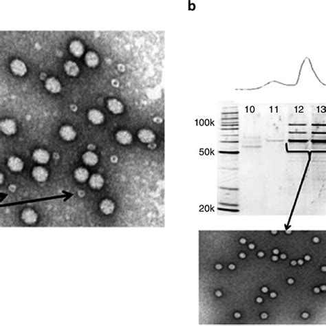 Depiction Of Recombinant Adeno Associated Virus RAAV Manufacturing