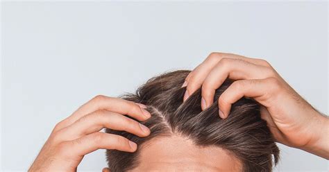 Crostas e feridas no couro cabeludo tratamento causas e remédios Respostas Sempre Atualizadas