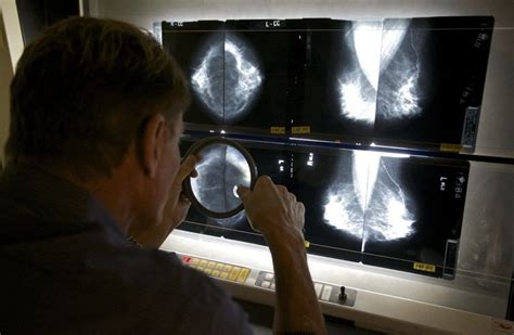 Breast cancer is on the list of diseases and conditions caused or worsened by being overweight or obese after menopause. Breast cancer risk from menopause hormones may last ...