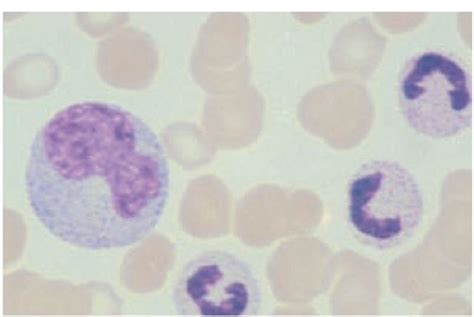 A Monocyte Large Cell At Left Which Can Reach 17 M In Diameter Has