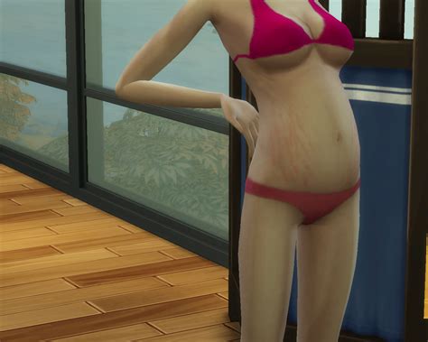 Mod The Sims Stretch Marks