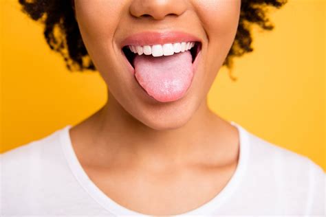 Mykose Der Zunge Wie Kann Man Vorbeugen Und Heilen
