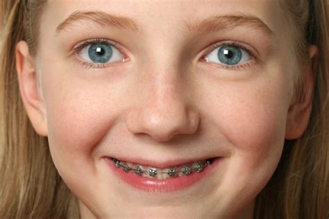 Treating Orthodontic Pain At Home