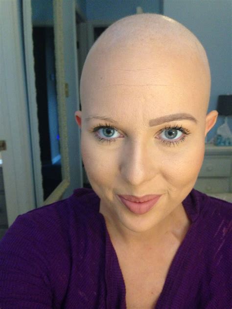 But hair loss hasn't changed that i'm so excited now. Hair is Overrated! | My Cancer Chic | Chemo hair, Chemo ...