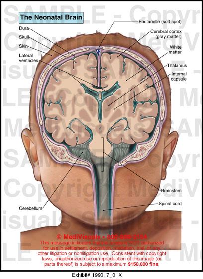 Medivisuals The Neonatal Brain Medical Illustration