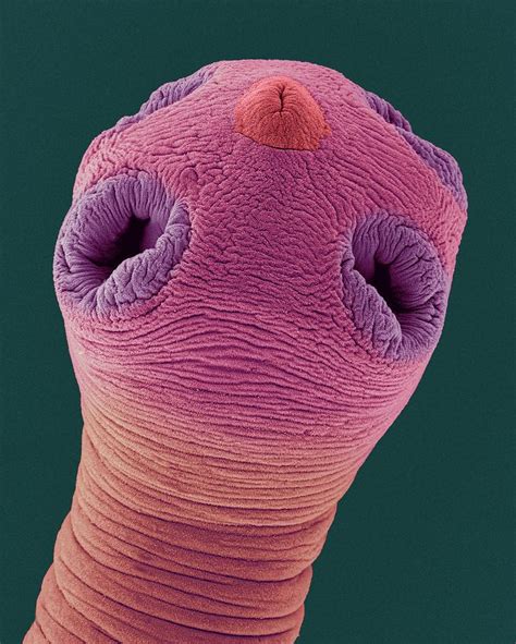 Dog Tapeworm Scolex Dipylidium Caninum Photograph By Dennis Kunkel