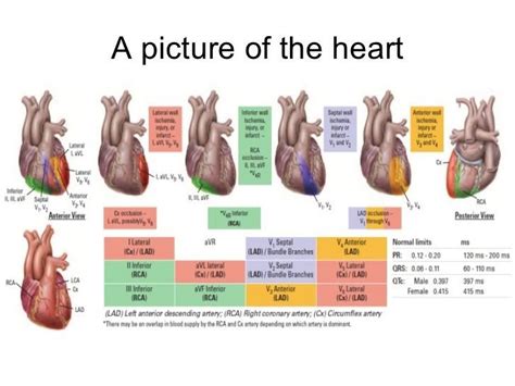 Image Result For Cardiac Monitoring 12 Leads Arteries Anatomy