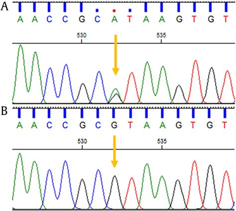 The Sanger Sequencing Electropherograms Proband With Heterozygous Download Scientific Diagram