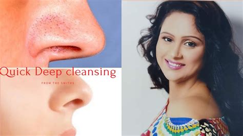 Hommad Deep Cleansing Facial For Pimplblackheads Get Instant Clean Clear Smooth Glowing At