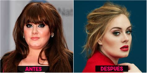 Cirugías De Adele Antes Y Después Cirugiasde