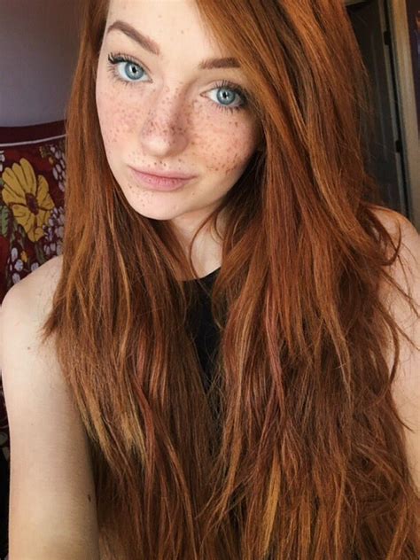 Pin By Pinnocence On Taches De Rousseur Beautiful Freckles Red Hair