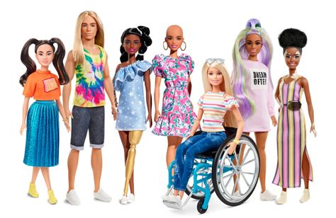 Barbie Unveils New Inclusive Dolls With Vitiligo And Another With