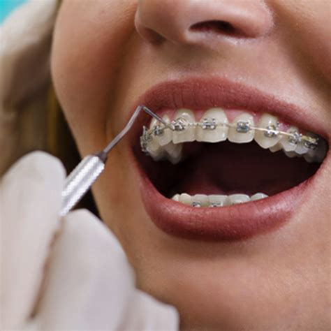 Orthodontics Fmh