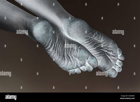 Dehydrated Skin Female Heels Stock Photo Alamy