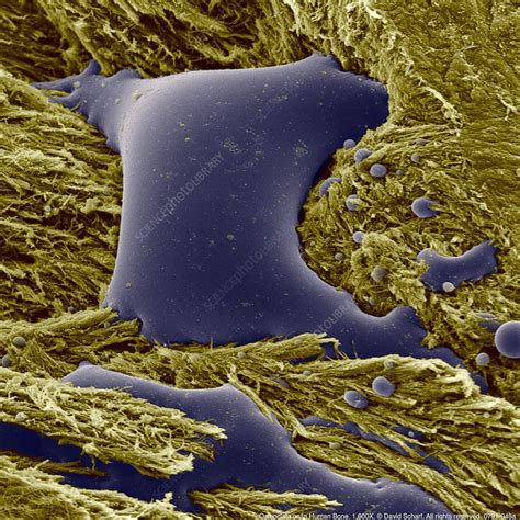 Coloured Sem Of Osteoclasts In Human Bone Stock Image P1050088