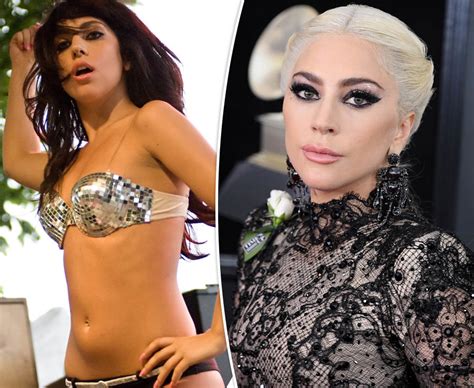 Lady Gaga Face Lift Plastic Surgeon Gives Verdict On Singers Dramatic Transformation Daily Star