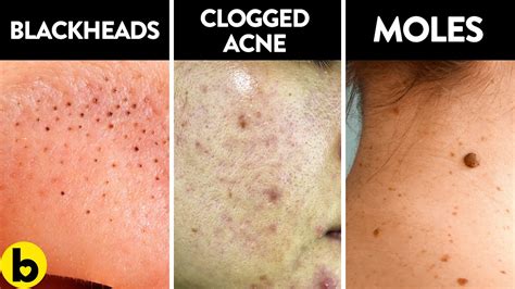 8 Serious Diseases That Are Signaled By Our Skin Youtube