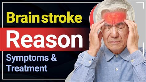 Brain Stroke Reason Symptoms And Treatment Explained Brain Stroke